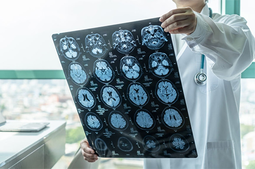 neurocirujano en star medica